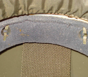 Cerclage, détail fixation. Cerclage, détail fixation.