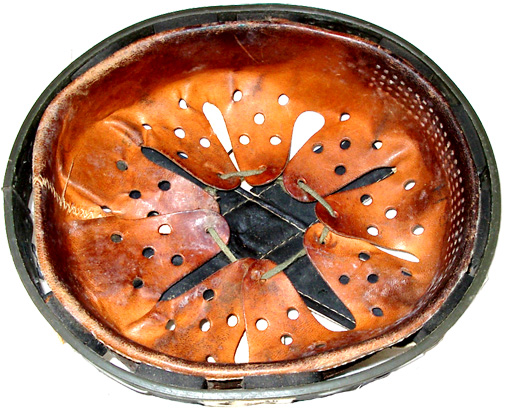 Ensemble cerclage-coiffe. Ensemble cerclage-coiffe.