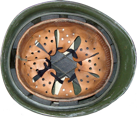 Ensemble cerclage-coiffe en place. Ensemble cerclage-coiffe en place.