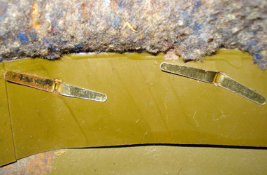 Cerclage et attaches parisiennes. Cerclage et attaches parisiennes.