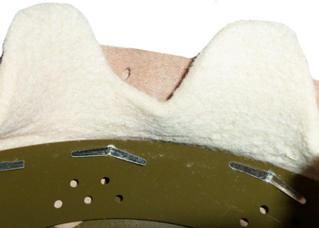 Cerclage et attaches parisiennes. Cerclage et attaches parisiennes.