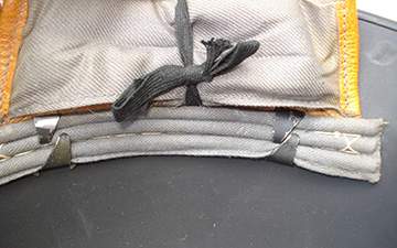 Cerclage : Fixation latérale. Cerclage.