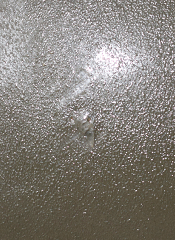 Point d'injection au niveau sommital. Point d'injection au niveau sommital.