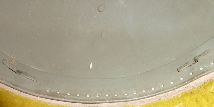 Cerclage métallique et points de fixation avant.