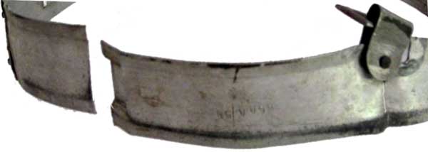 Ce cerclage en aluminium 1er type (Max Densow 1937) démontre sa fragilité. Ce cerclage en aluminium 1er type (Max Densow 1937) démontre sa fragilité.