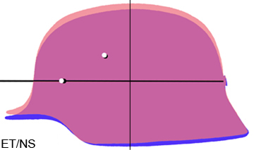 Superposition ET/NS au niveau des plans de coiffe. Superposition ET/NS au niveau des plans de coiffe.