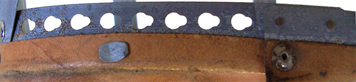 Cerclage fermé sur 61 de tour de tête. Cerclage fermé sur 61 de tour de tête.