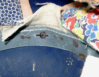 Cerclage, avant gauche. Cerclage, avant gauche.