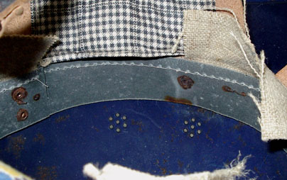 Cerclage, arrière et côté droit. Cerclage, arrière et côté droit.