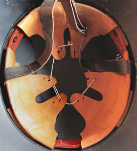 Variante : cerclage rouge sans doublure. Variante : cerclage rouge sans doublure.