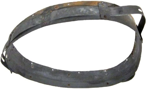 Cerclage côté droit.