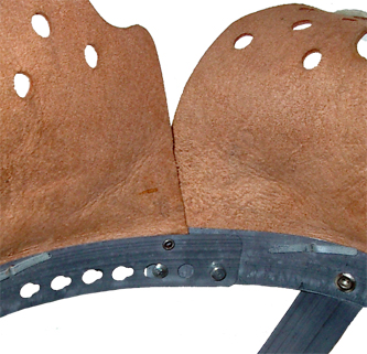 Cerclage verrouillé, envers.