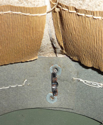 Cerclage et fixation. Cerclage et fixation.