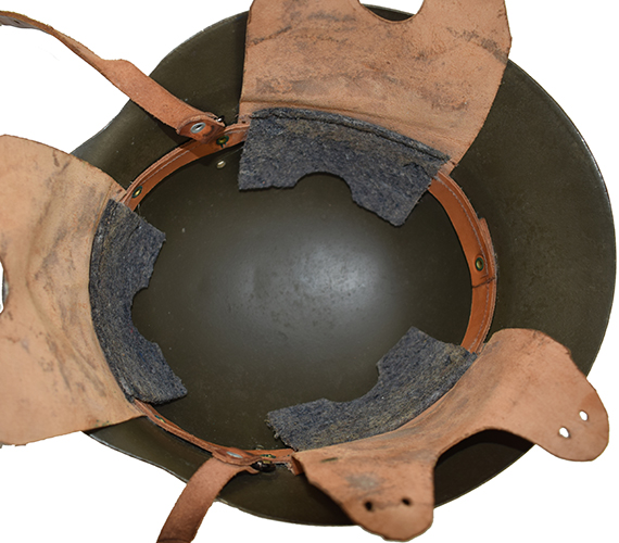 Cerclage, vue d'ensemble. Cerclage, vue d'ensemble.