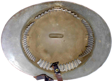 Implantation des plaquettes de 3 et 5 mm (bombe B taille 56). Implantation des plaquettes de 3 et 5 mm (bombe B taille 56).