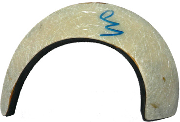 Renfort stratifié latéral droit.