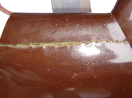 Jointure cerclage. Jointure cerclage.