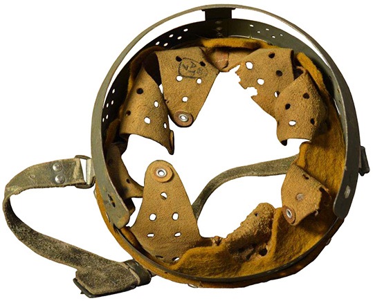 Coiffe avec cerclage.