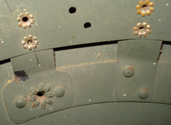 Armature du cerclage, fixation latérale.