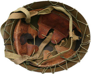 Fixation par lacet. Fixation par lacet.