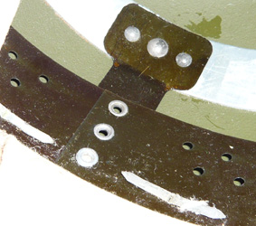 Fixation de la coiffe au cerclage.