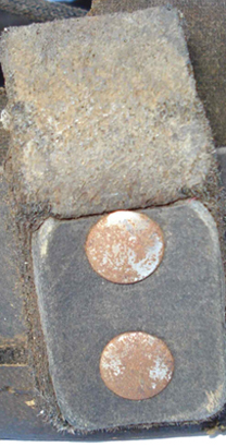 Tampon cerclage. Tampon cerclage.