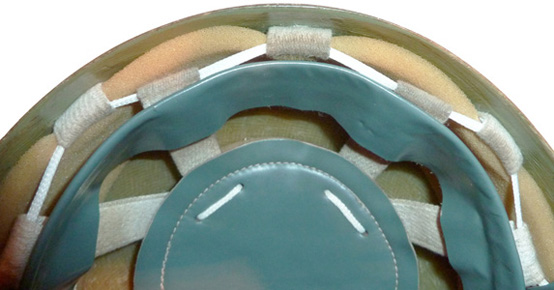 Détail montage de la coiffe. Détail montage de la coiffe.